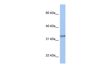 ACBD4 Antibody