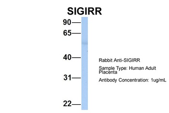 SIGIRR Antibody