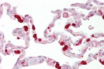 GSTT1 Antibody