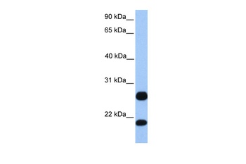 C1orf63 Antibody