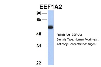 EEF1A2 Antibody