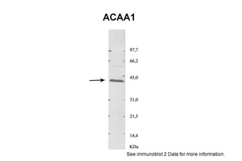 ACAA1 Antibody