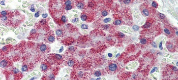 ACAA1 Antibody