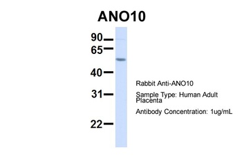 TMEM16K Antibody