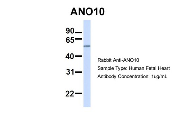 TMEM16K Antibody