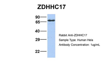 ZDHHC17 Antibody