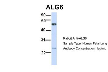 ALG6 Antibody