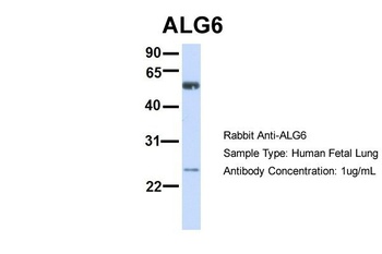 ALG6 Antibody