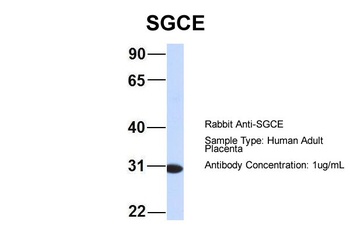 SGCE Antibody