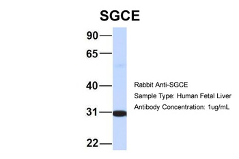 SGCE Antibody