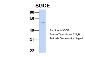 SGCE Antibody