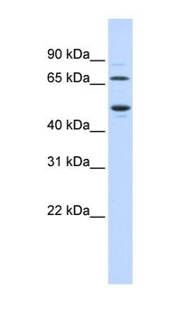 TDO2 Antibody