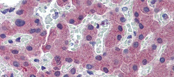 TFR2 Antibody