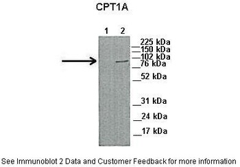 CPT1A Antibody