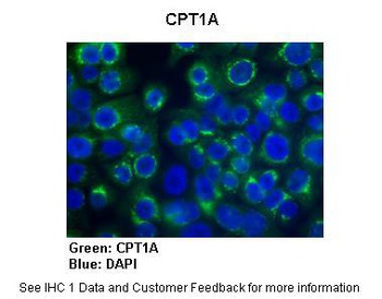 CPT1A Antibody