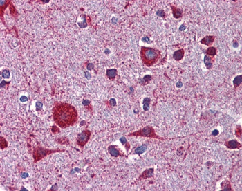 LRP8 Antibody