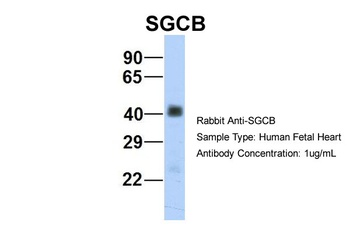 SGCB Antibody