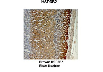 HSD3B2 Antibody