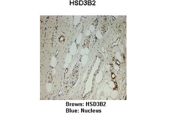 HSD3B2 Antibody