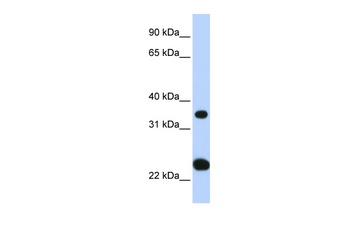 SLC25A35 Antibody