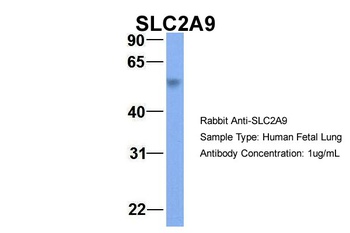 SLC2A9 Antibody