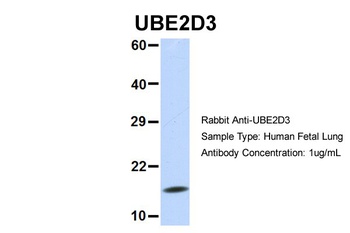 UBE2D3 Antibody