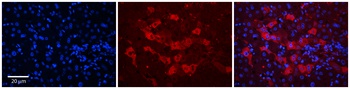 DCAF11 Antibody