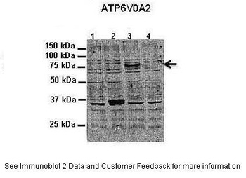 ATP6V0A2 Antibody