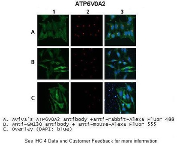 ATP6V0A2 Antibody