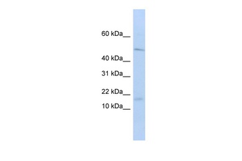 VPREB1 Antibody