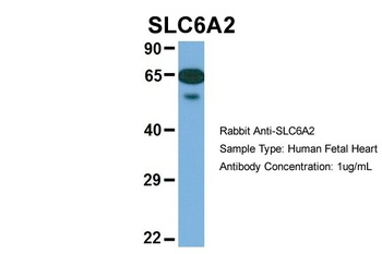 SLC6A2 Antibody