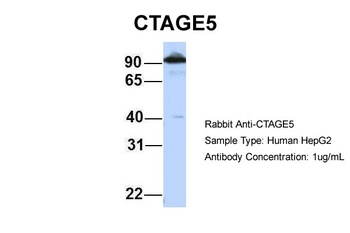CTAGE5 Antibody
