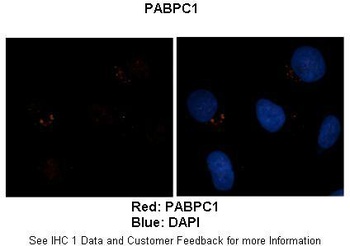 PABPC1 Antibody