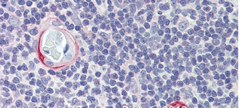 CPXCR1 Antibody