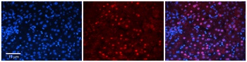 ZNF419 Antibody