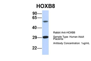 HOXB8 Antibody
