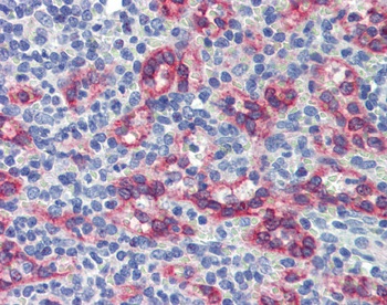 ZNF71 Antibody