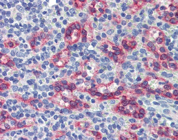 ZNF71 Antibody