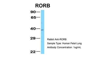 RORB Antibody