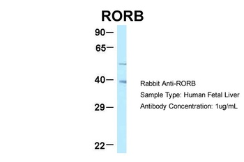 RORB Antibody