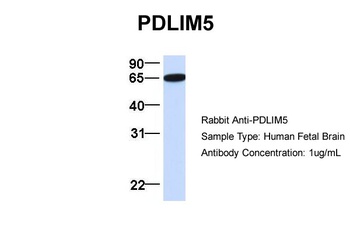 PDLIM5 Antibody