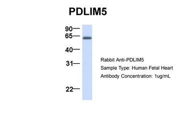 PDLIM5 Antibody