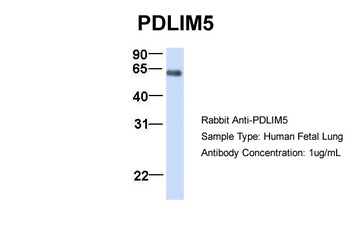 PDLIM5 Antibody