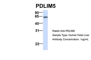 PDLIM5 Antibody