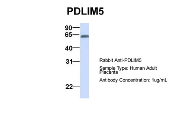 PDLIM5 Antibody