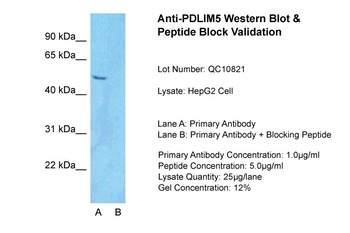 PDLIM5 Antibody