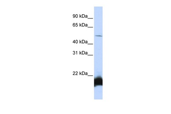 ONECUT1 Antibody