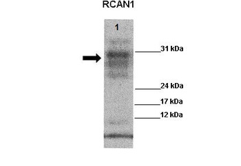 RCAN1 Antibody