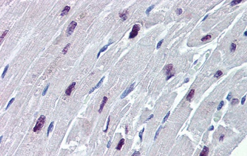 SOX4 Antibody