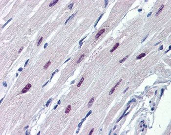 SOX4 Antibody